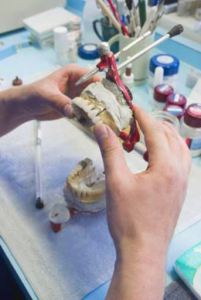 Denture rebasing when the teeth of your denture are still in good condition